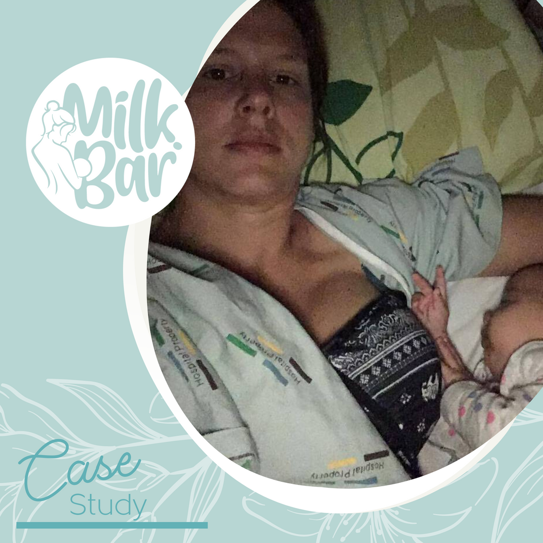 Case Study | Pumping Through Breast Surgery Recovery