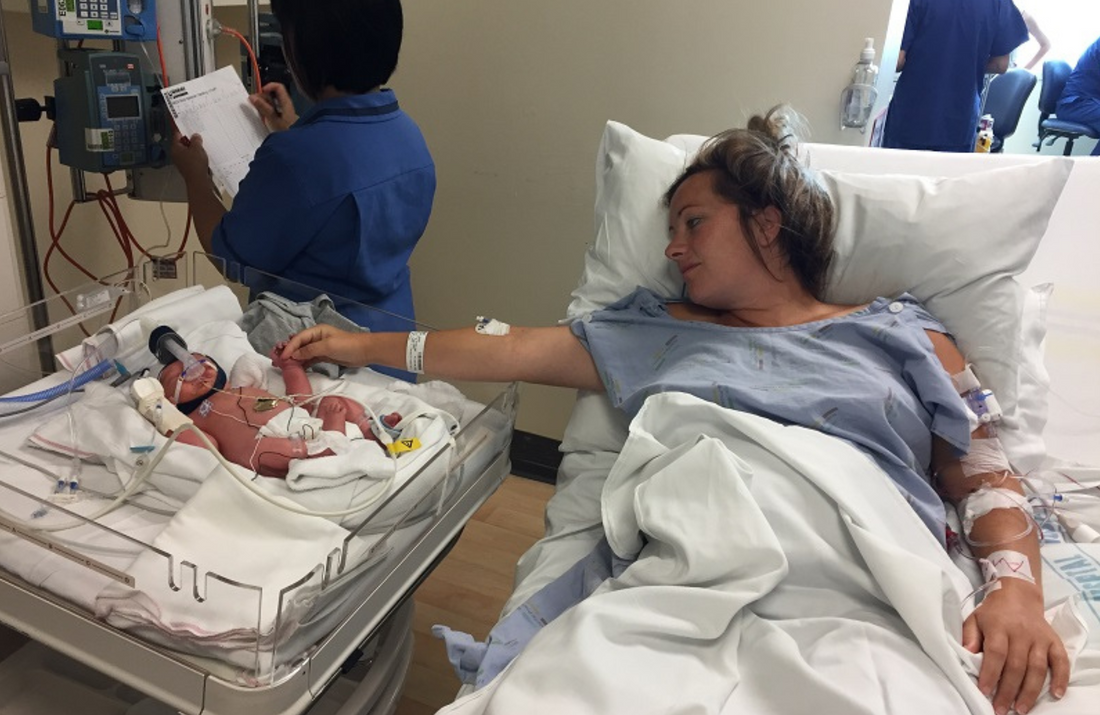 Nurturing Your Premature Baby: A Guide to Breastfeeding in the NICU