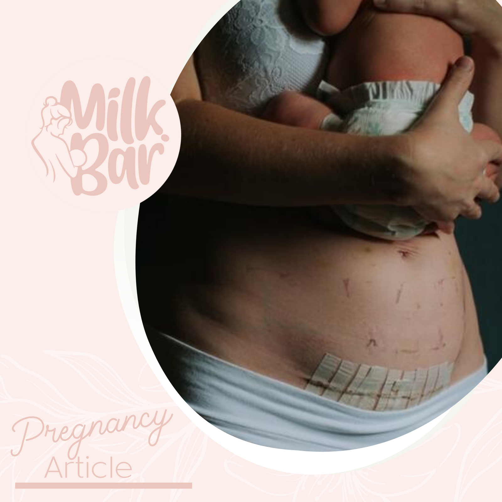 16 Must Have C-Section Recovery Kit Items - Milk Drunk